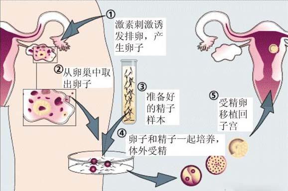 供卵很多不成功的(供卵繁多却不成功)