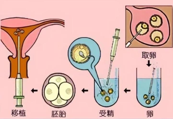 供卵生下的孩子能入户吗_供卵生下的孩子是否能够入户？