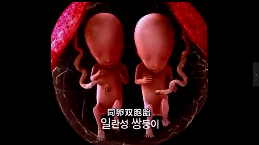 代生孩子双胞胎(一对双胞胎:代生孩子的奇迹)