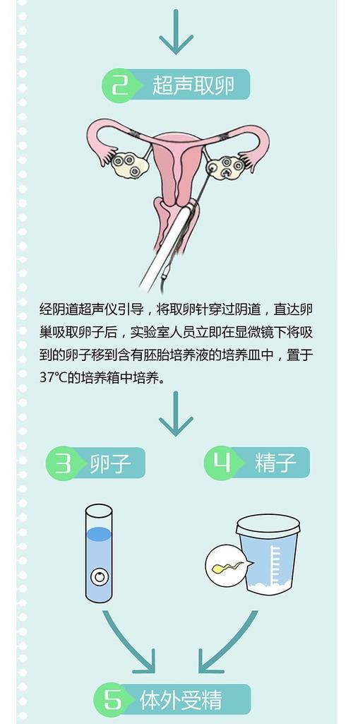 供卵试管代怀流程-供卵试管代怀流程解析及注意事项